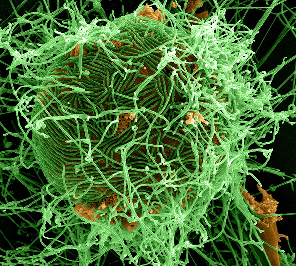 Ebola, How New York Hospitals Brace for Pandemics